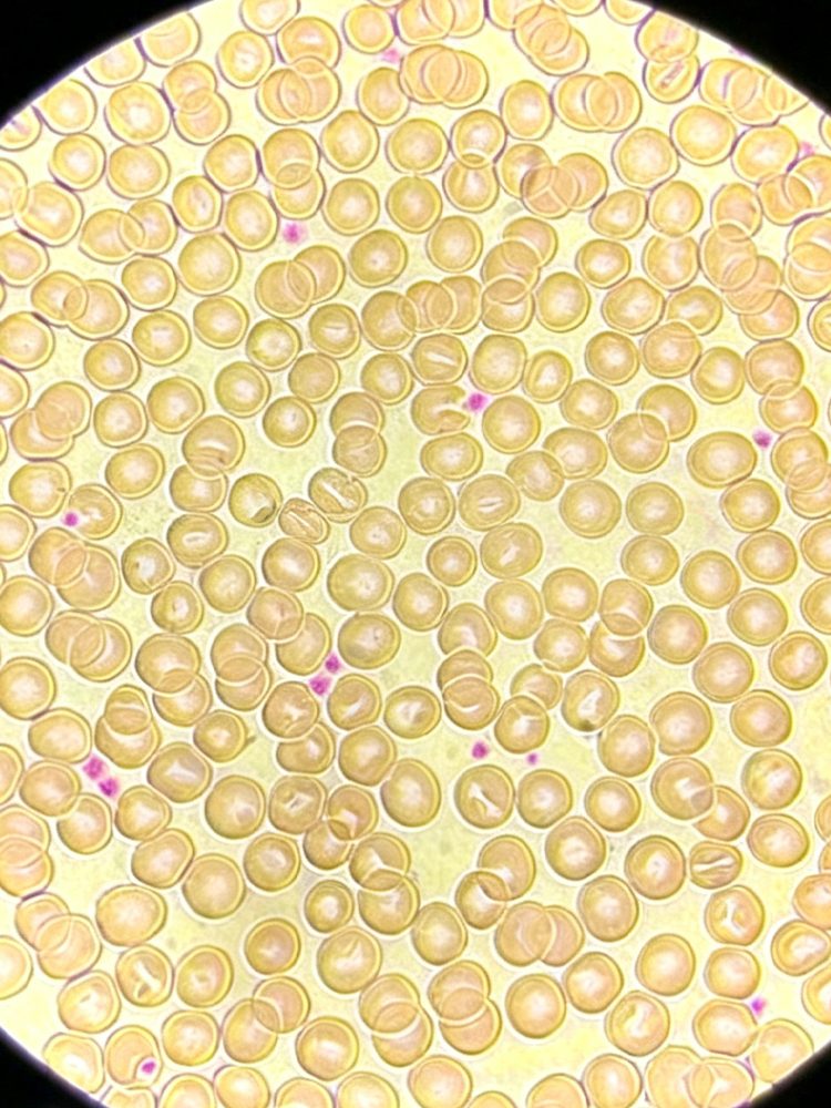 Live Blood Test in use